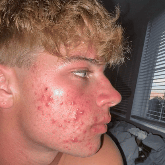 Feature product image