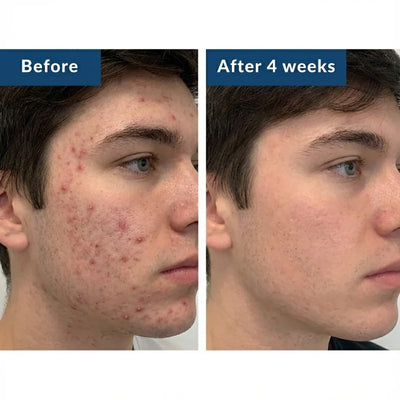 GHK-Cu Peptides Serum