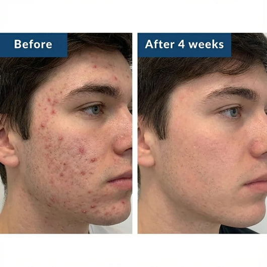 GHK-Cu Peptides Serum